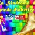 La sindrome del piede diabetico nm